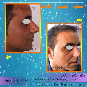 جراح أنف جيد في الأهواز