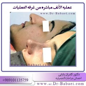 منع الجروح بعد عملیه الانف