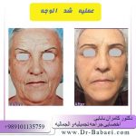 تکلفه شد الوجه