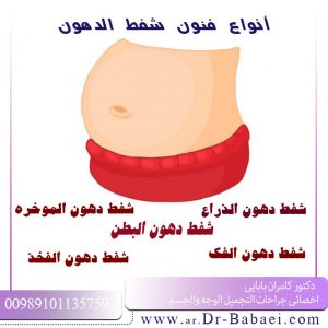 الضعف مع شفط الدهن
