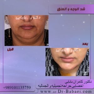 كيفية شد الوجه