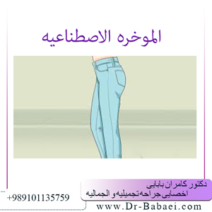 الموخره-الاصطناعیه