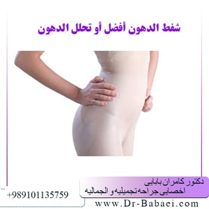 شفط الدهون أفضل أو تحلل الدهون     