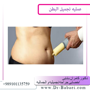 عملیه-تجمیل-البطن