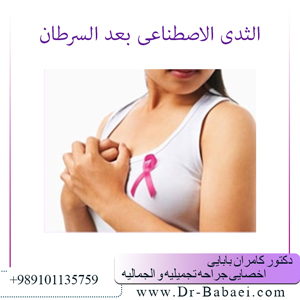 الثدی الاصطناعی بعد السرطان